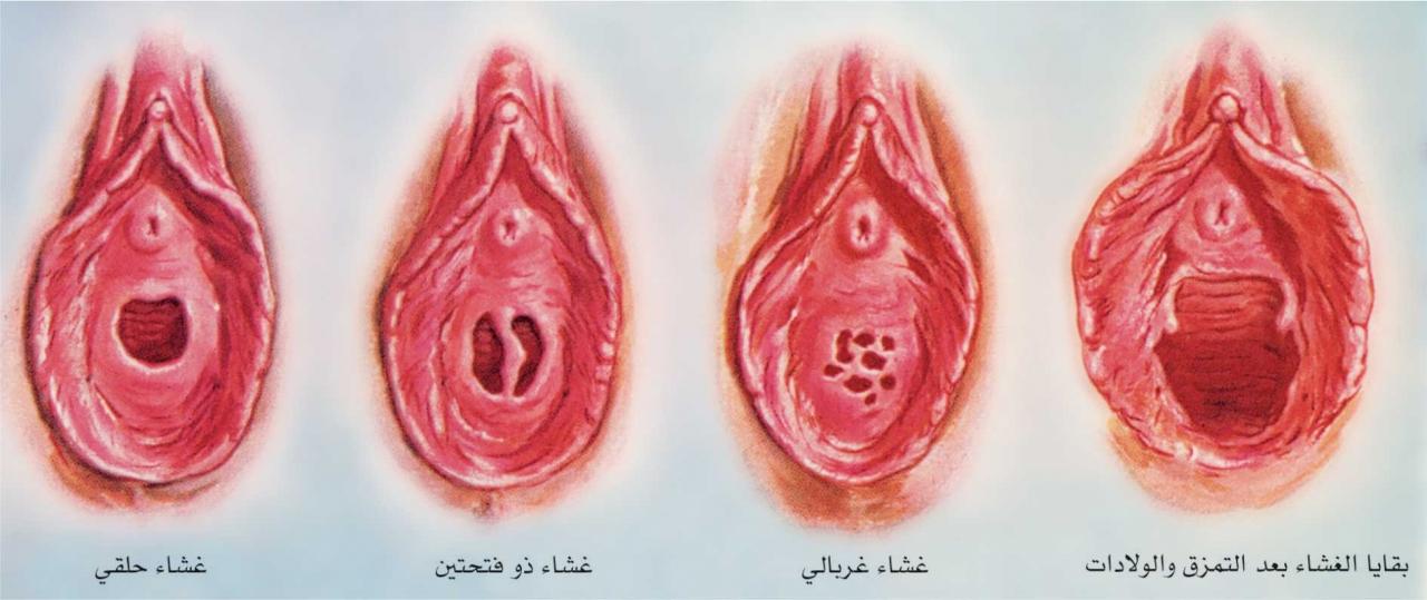 الفرج عند المرأة معلومات اول مره اعرفها 8010 1