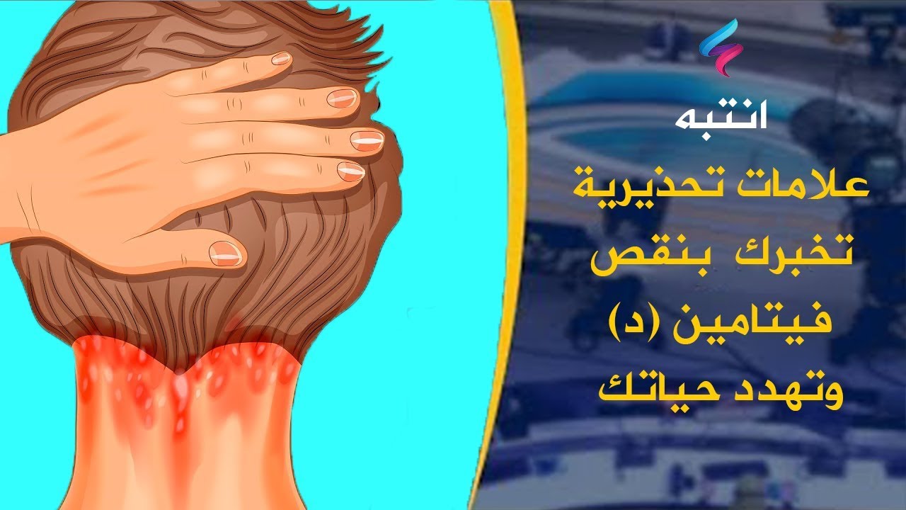 اعراض نقص فيتامين د 218